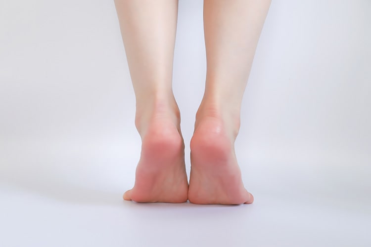 アキレス腱断裂